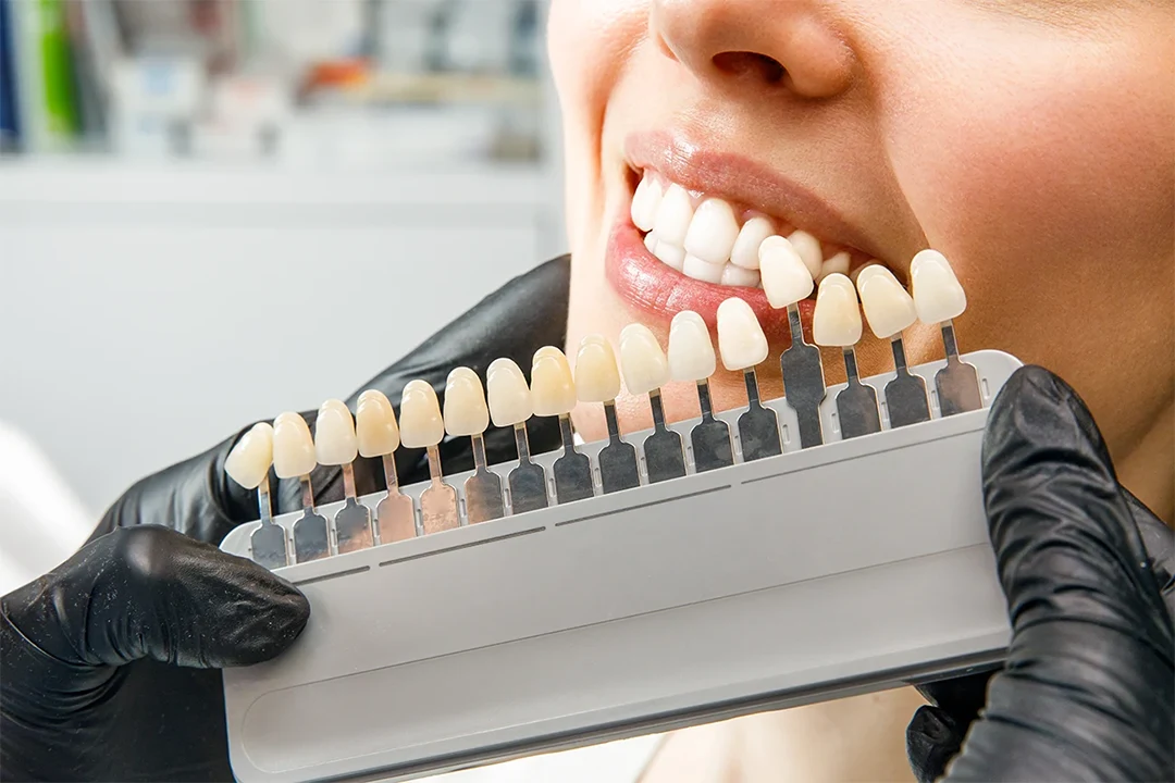 Igiene dentale in gravidanza