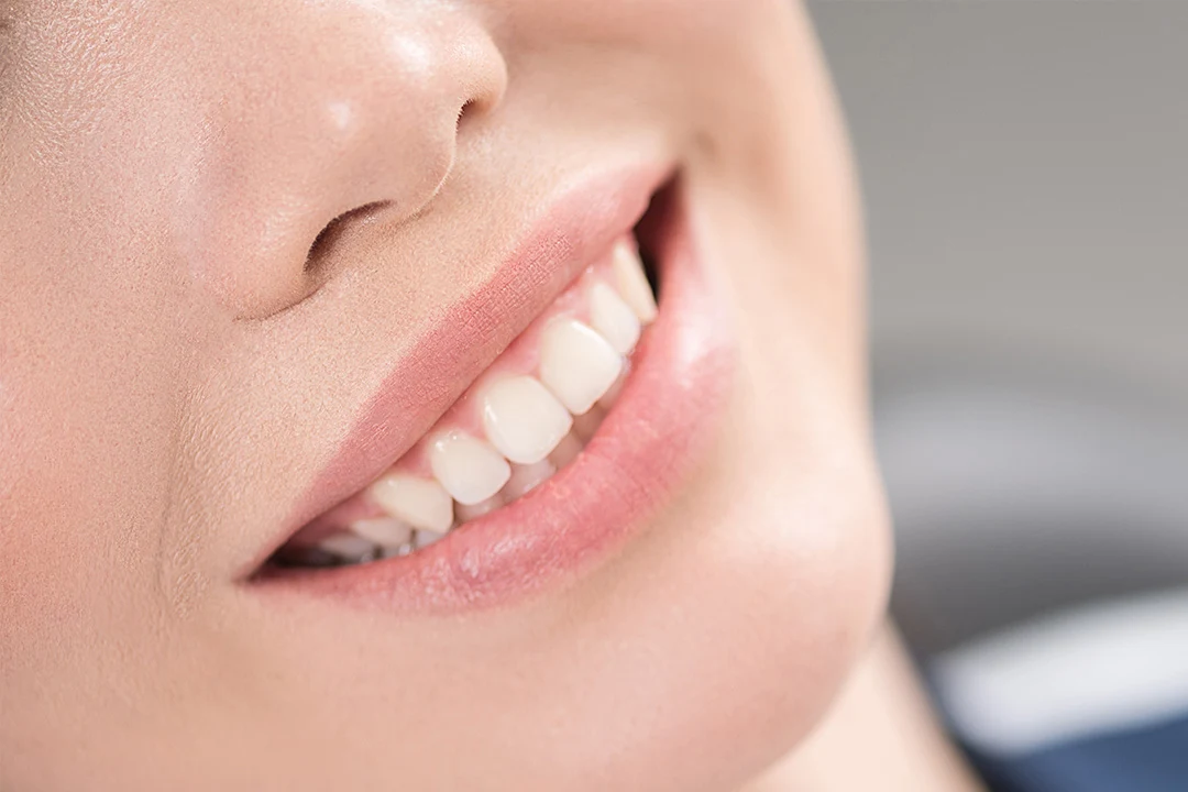 Ricostruzione denti