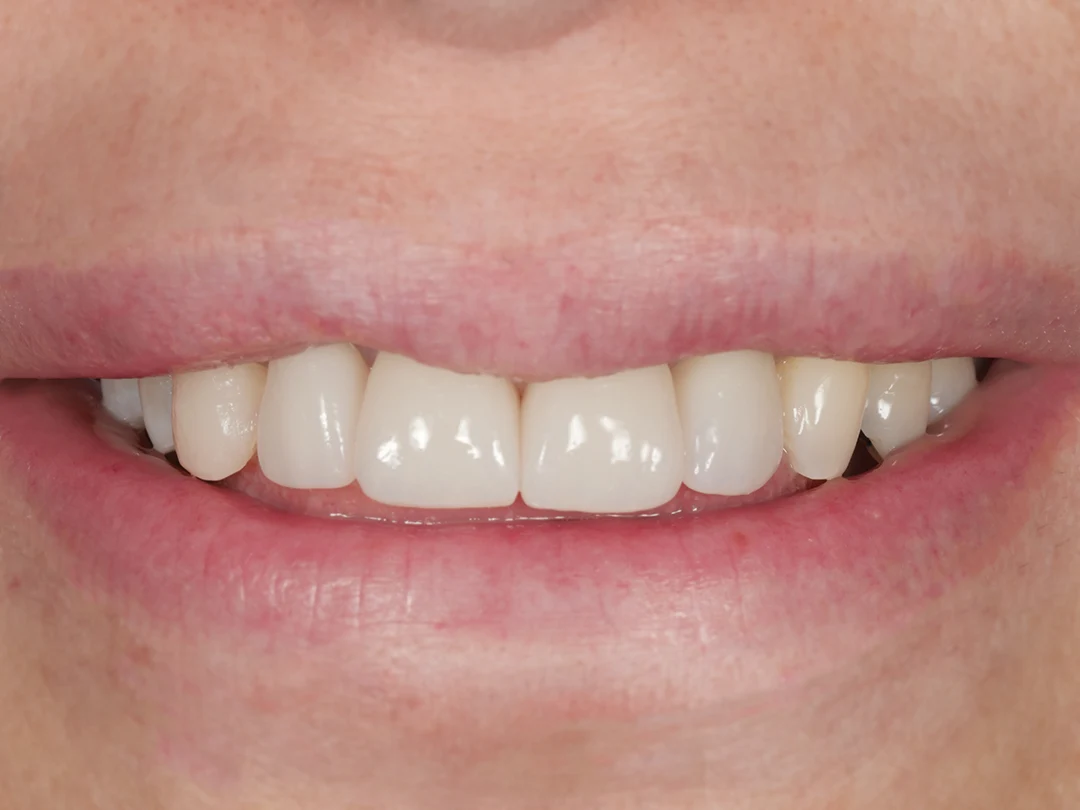 Prima